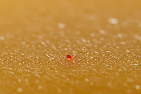 Wax Reactions: Pinpoint Triggers for Smooth Skin in 2026